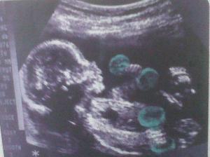 Baby_CrossFit_Ultrasound